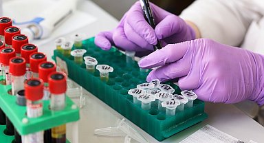 Oncosem'in test kitinin ürün takip sistemine kaydı