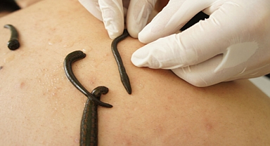 Yasa Dışı Tıbbi Sülük Ticareti Engellendi: 5 Bin Canlı Sülüğe El Konuldu