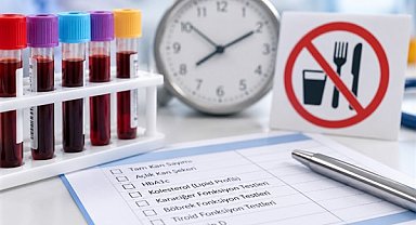Dr. Uzel: Kan tahlillerinde açlık süresi her test için aynı olmayabilir