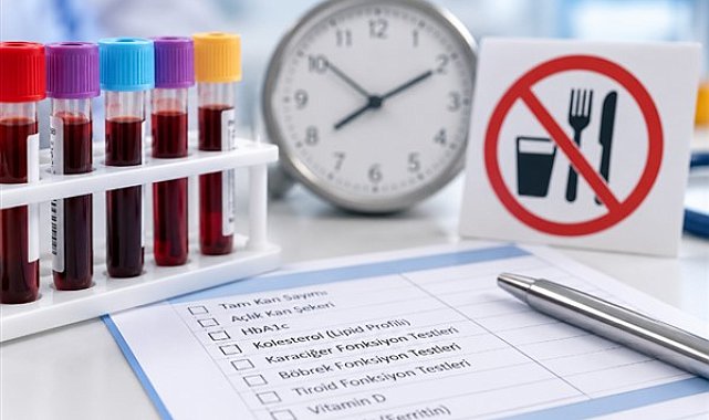 Dr. Uzel: Kan tahlillerinde açlık süresi her test için aynı olmayabilir